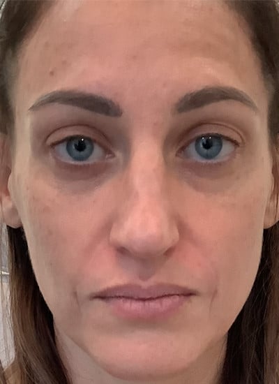 3603-imageset_1-after