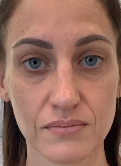 3603-imageset_1-before