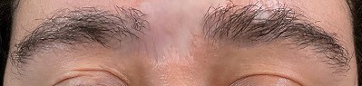 eyebrows-after