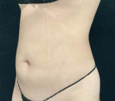 1_0001_image (1).png