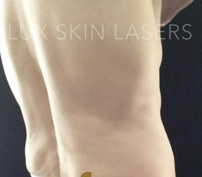 1_0003_image (2).png