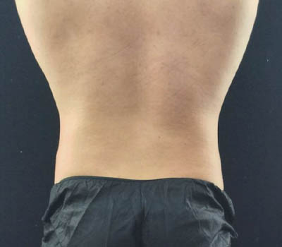 1_0005_image (3).png