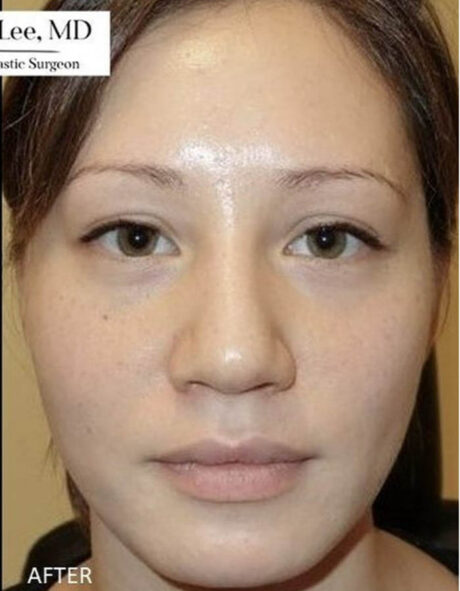 1_0000_botoxbxa2.png-copy-460×591