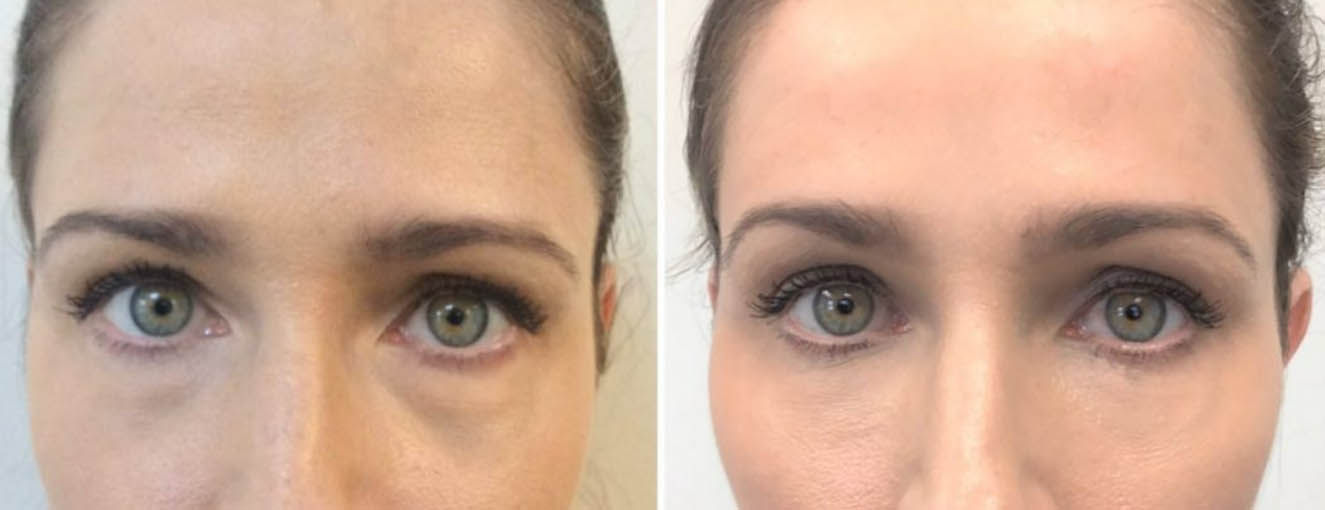 2_0006_image8.png copy